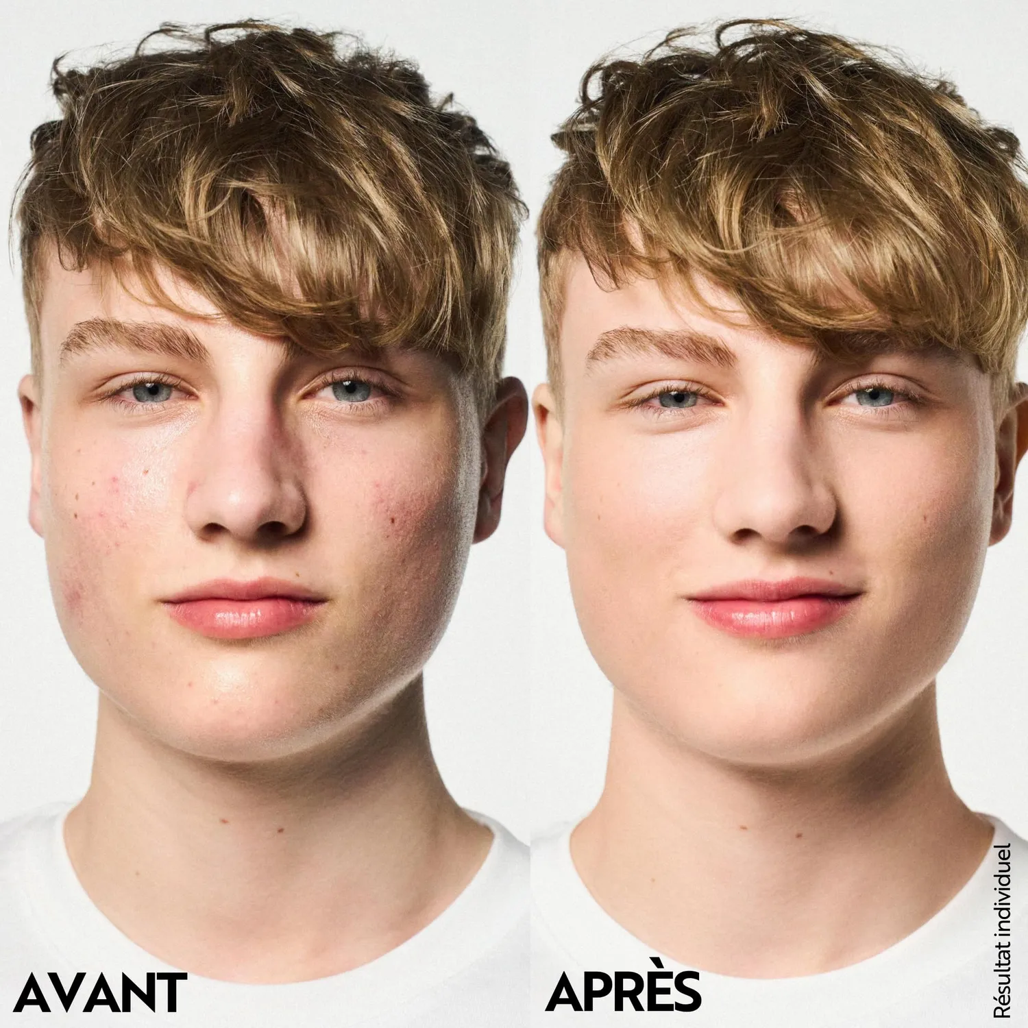 M. Asam Clear Skin crème visage anti-acné 24h 100 ml