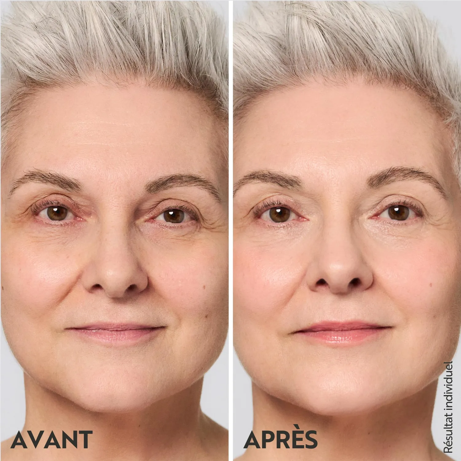 M. Asam Vinolift Crème Raffermissante 100 ml anti-rides