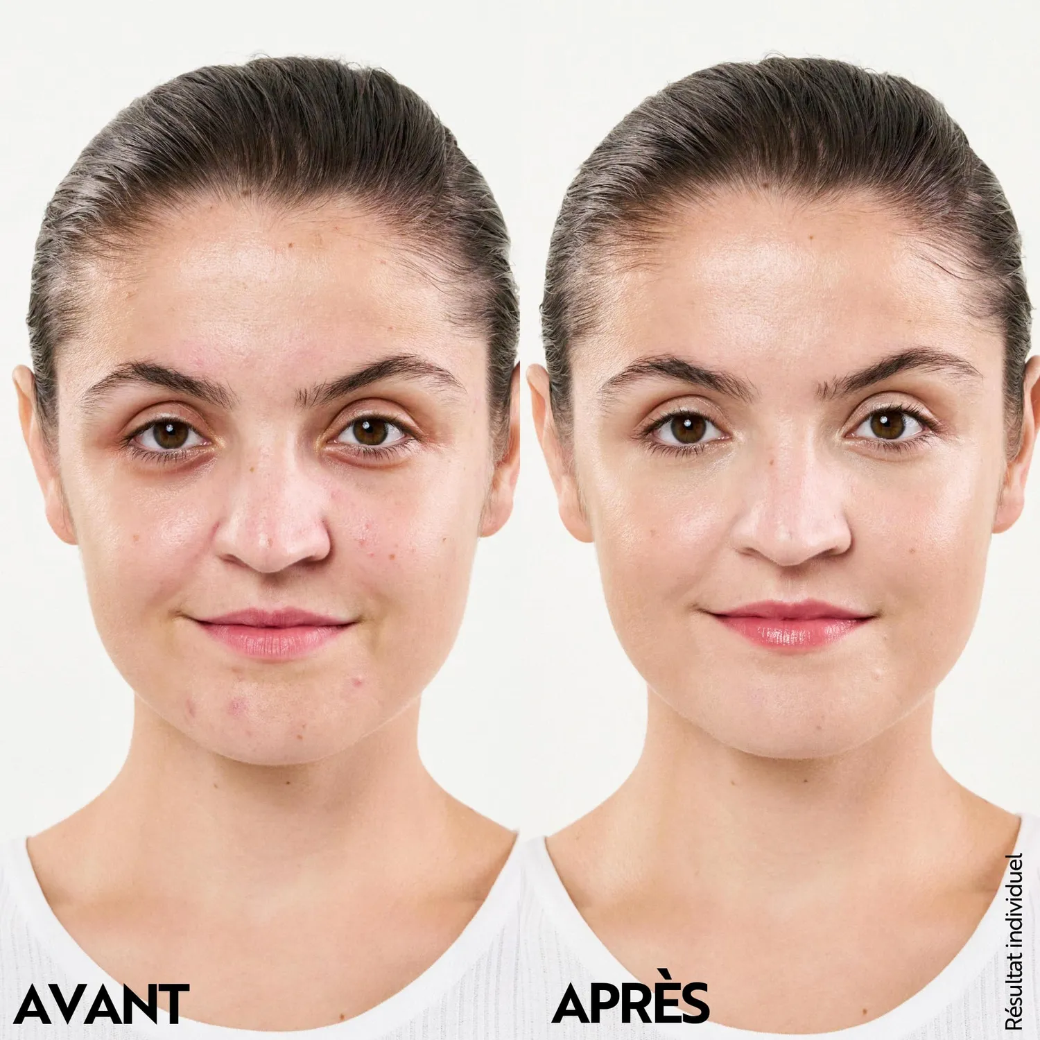 M. Asam Clear Skin crème visage anti-acné 24h 100 ml