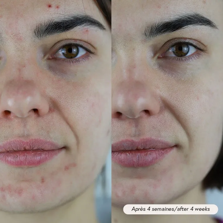 Absolution Pax huile visage apaisante CBD