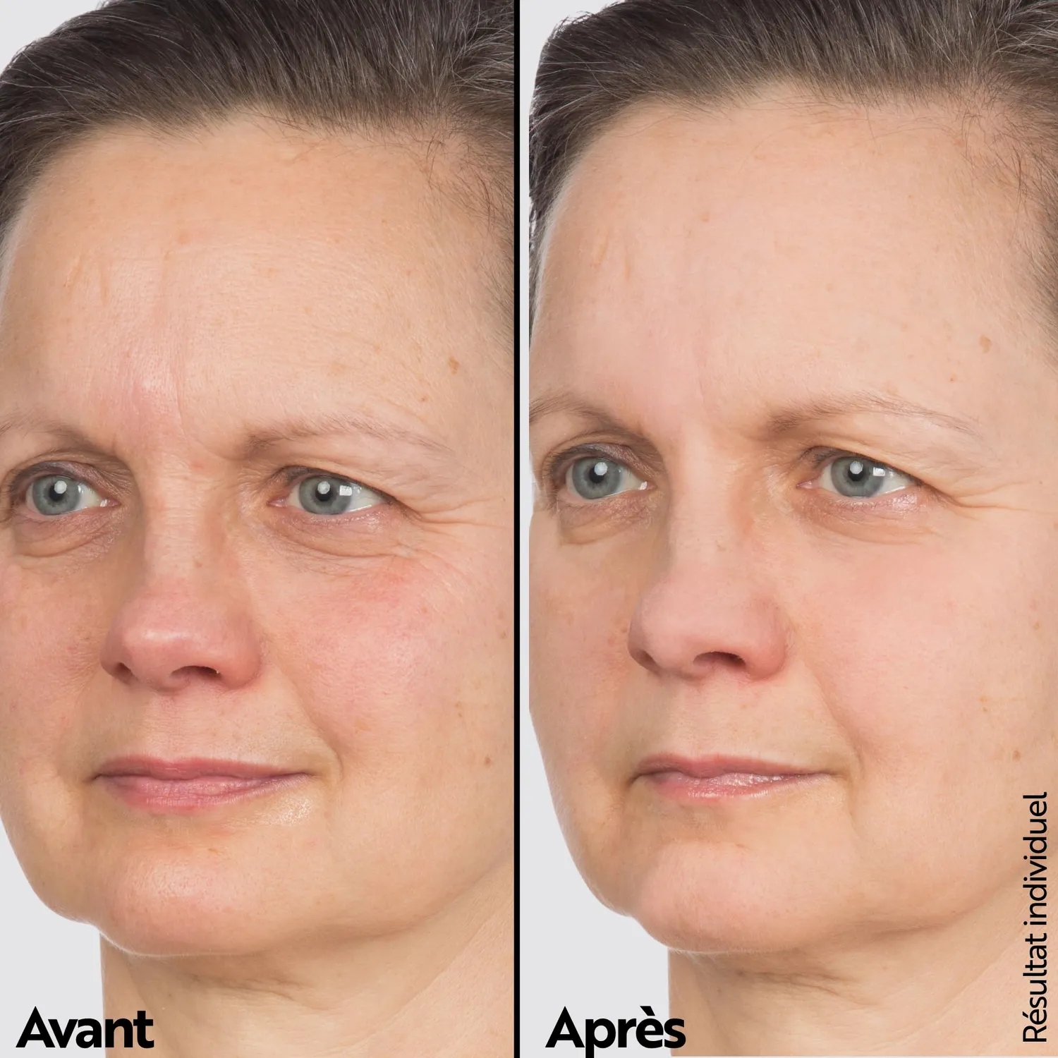 M. Asam Vinolift Overnight Lift essence nuit 50 ml peptides