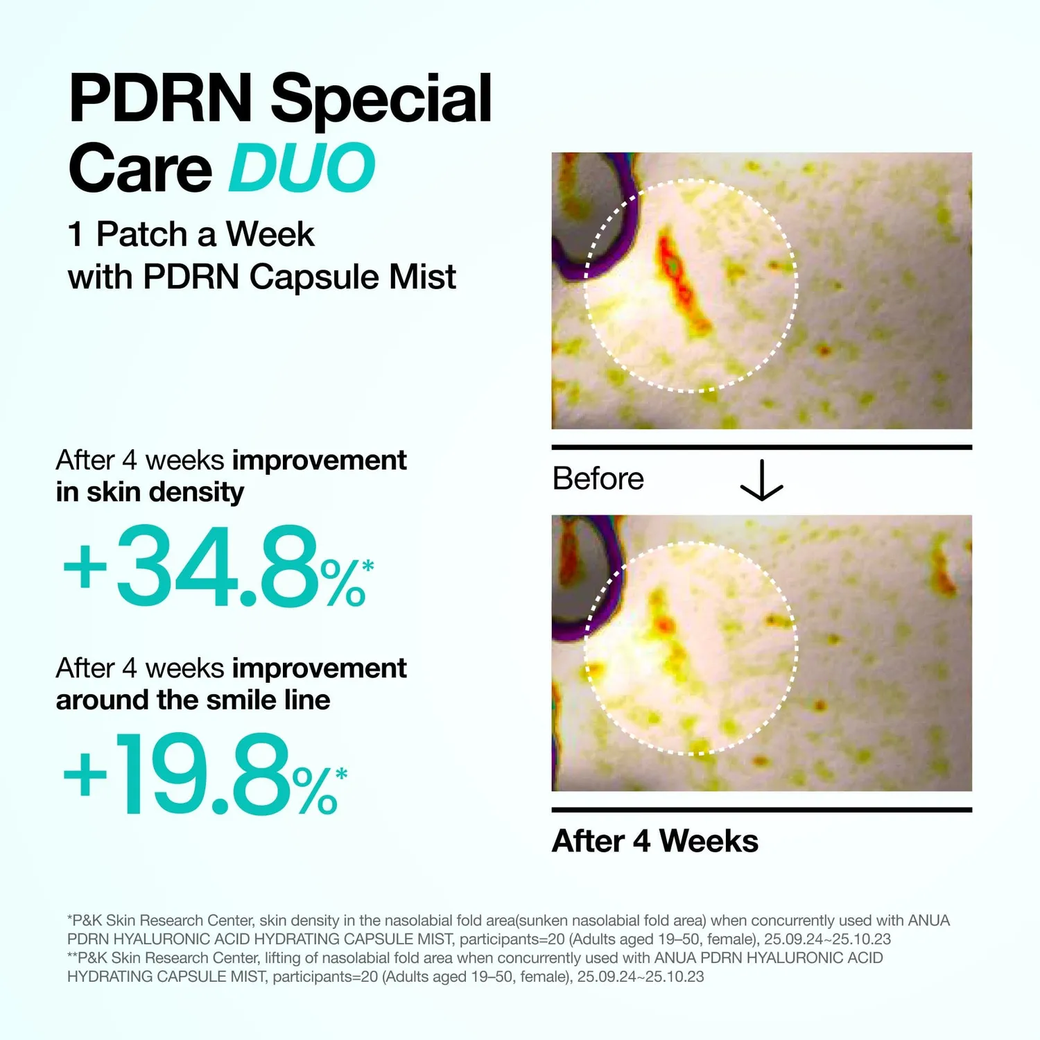 Anua PDRN Collagen patchs fondants 4 pièces fermeté