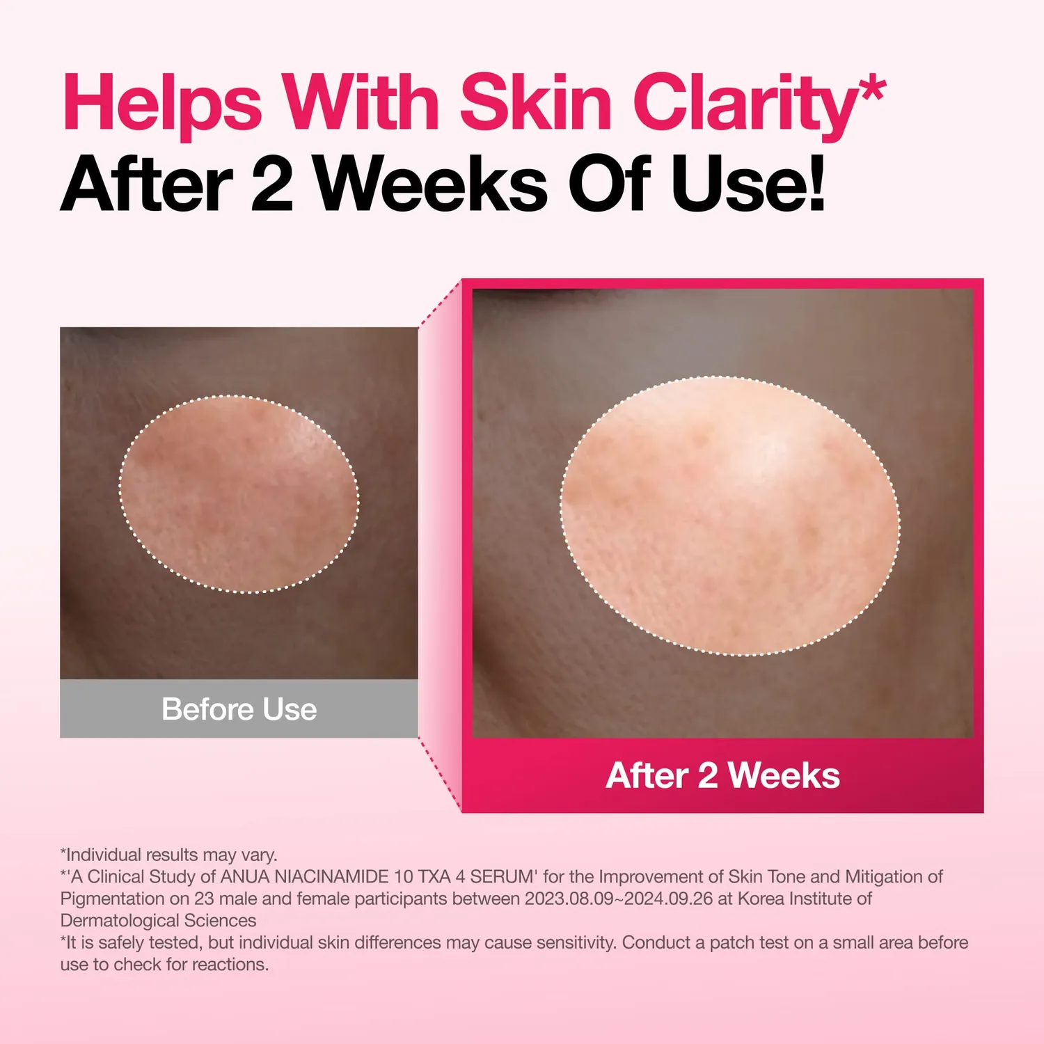 ANUA Spotless Skin duo sérums anti-taches éclat