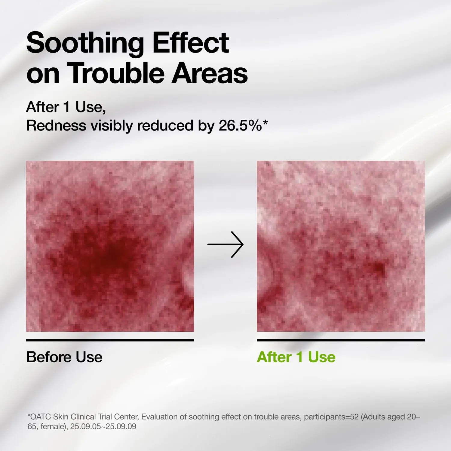 ANUA Azelaic Acid Cica crème apaisante