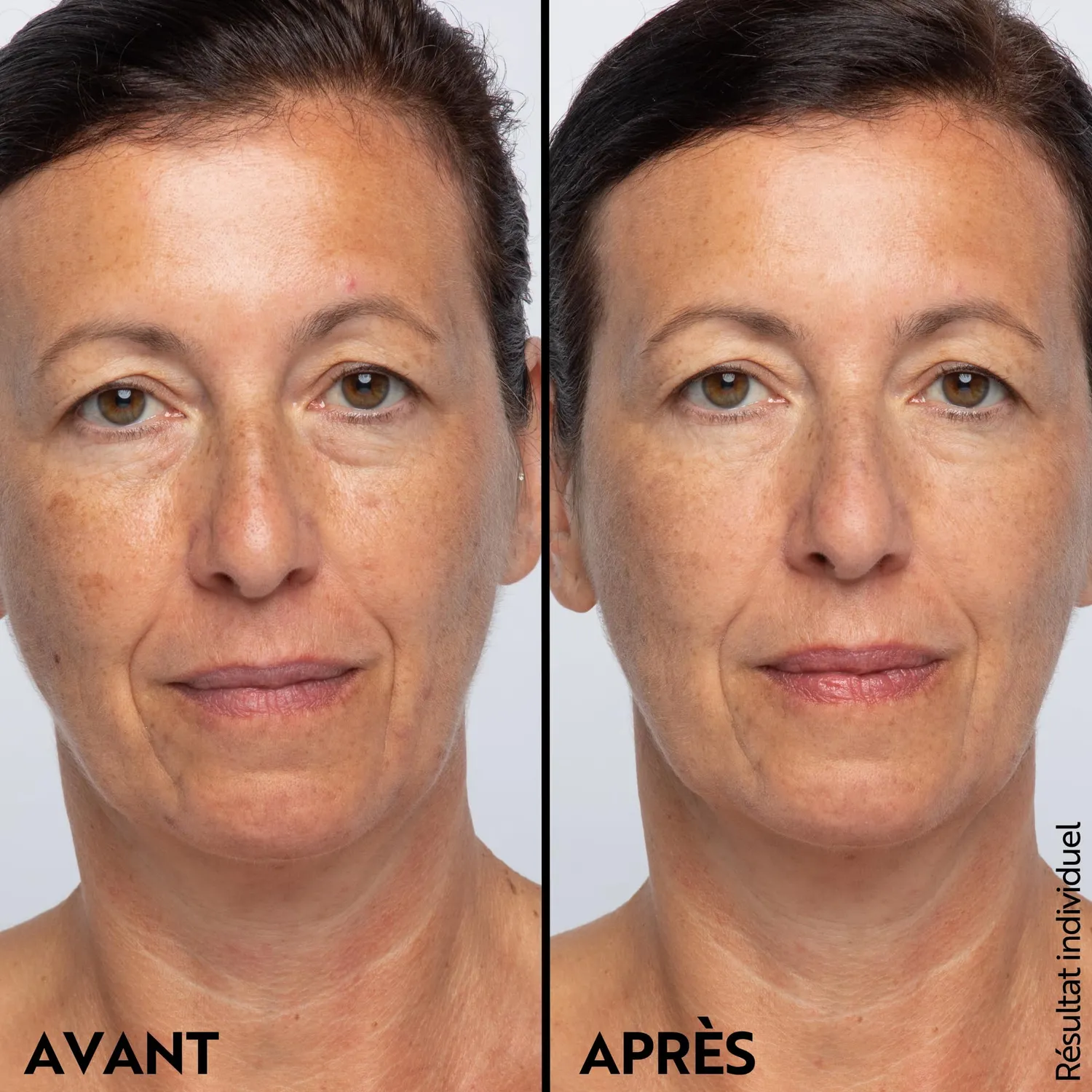 M. Asam Retinol Intense Soin yeux ridules 15 ml