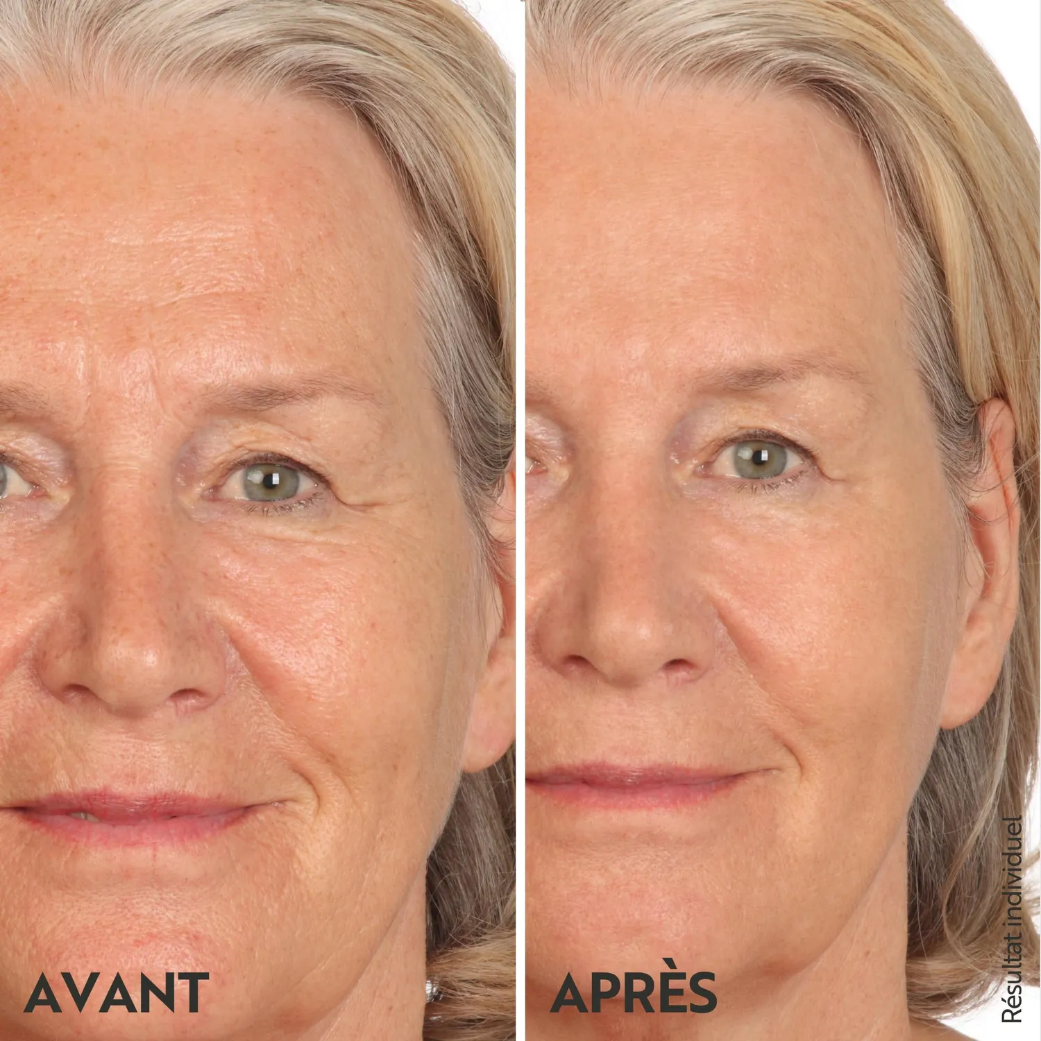 M. Asam Vinolift Crème Raffermissante 100 ml anti-rides