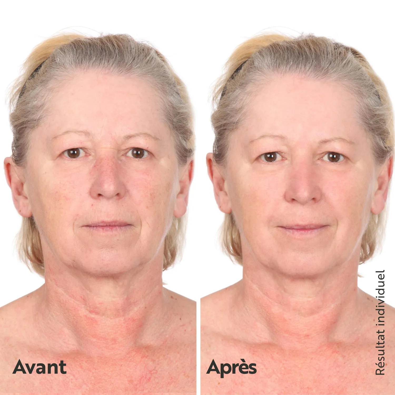 M. Asam Collagen Lift 24H Crème 50 ml repulpante