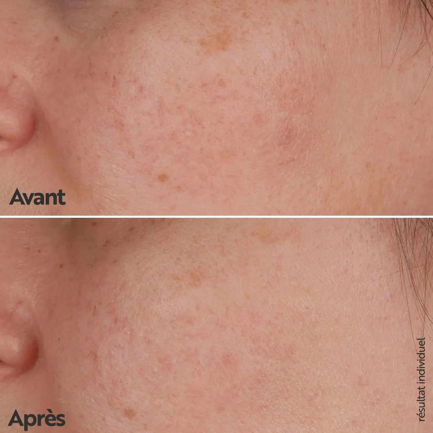 M. Asam Vitamin C Intense Sérum 10% 30 ml éclat