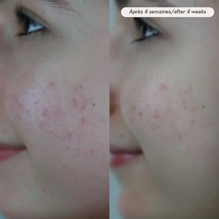 Absolution Pax huile visage apaisante CBD