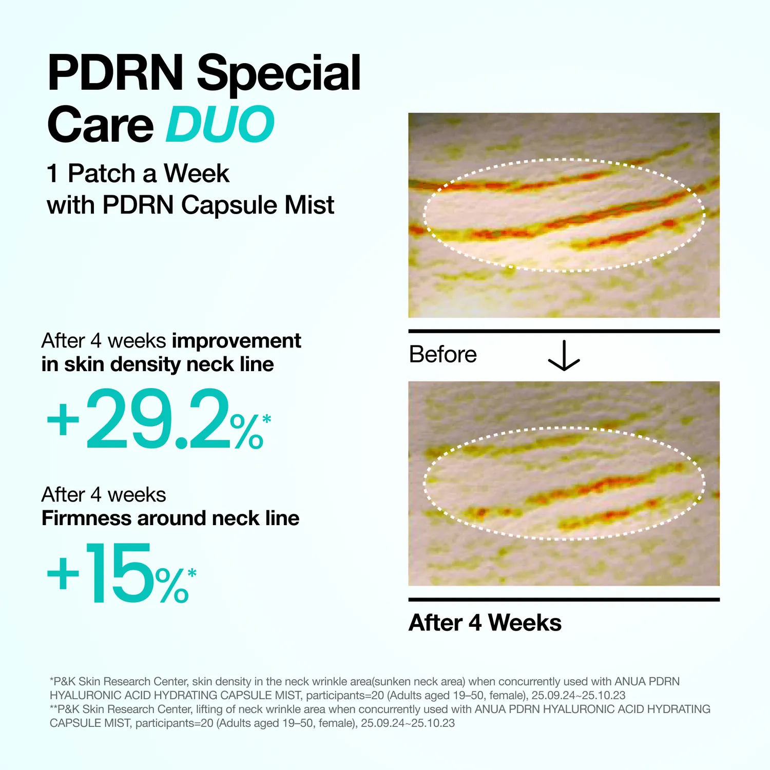 ANUA PDRN Collagen patch cou 4 pièces