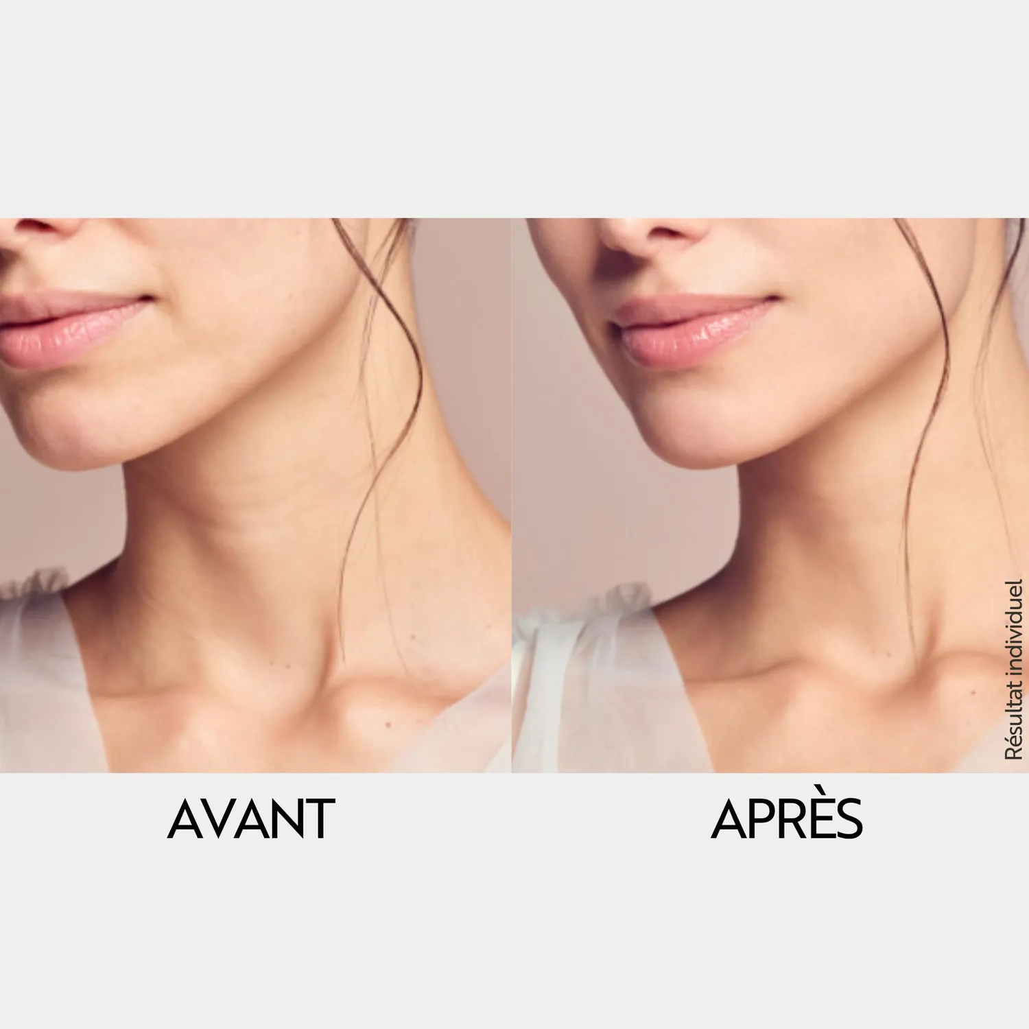 M. Asam Magic Care Super Lift crème cou décolleté 50 ml