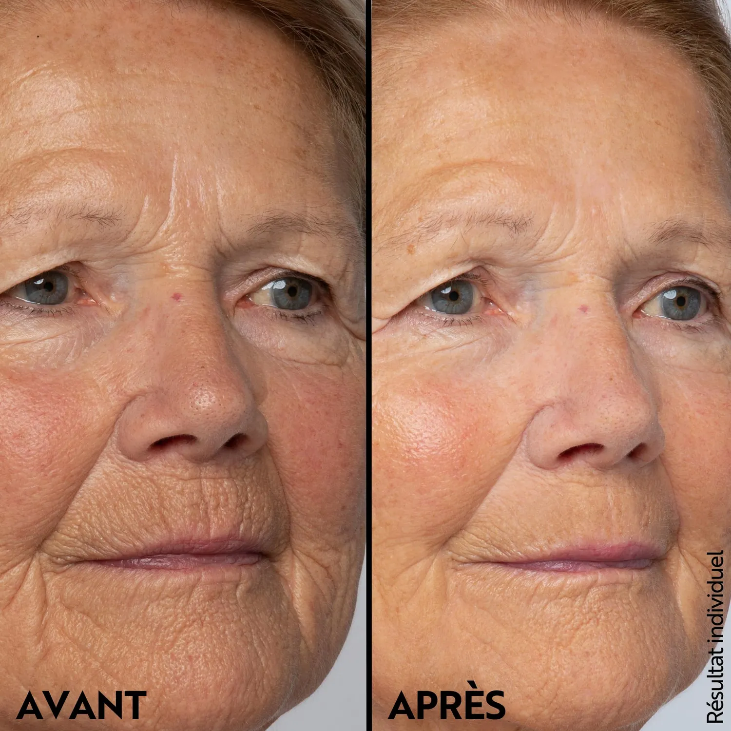 M. Asam Retinol Intense Soin yeux ridules 15 ml