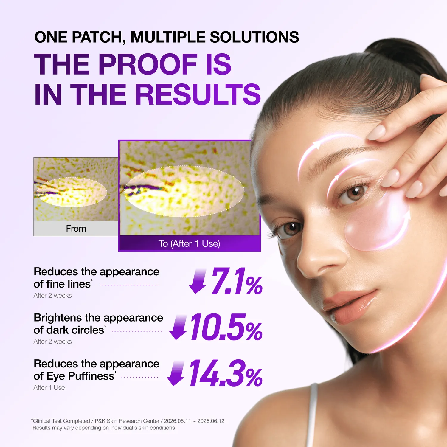 ANUA Retinol Berry patch yeux hydrogel anti-cernes