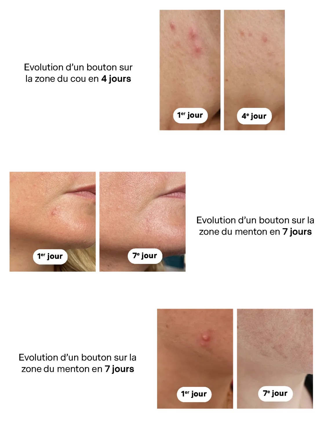 La Canopée Soin Ciblé Perfection soin anti-imperfections purifiant